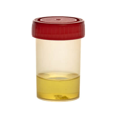 Urine samples: how to collect